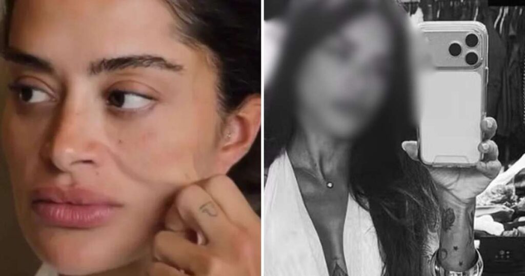 ex-bbb-aline-campos-faz-mais-uma-cirurgia-plastica-e-mostra-resultado:-‘fluido’